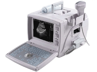 超声诊断仪 超声诊断仪